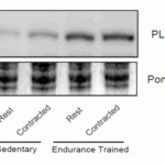 <strong>Figure 8  Induced Expression Validation of TIP47 in Rat Skeletal Muscle (Ramos et al., 2015) </strong><br>Mitochondrial red gastrocnemius muscle PLIN3 (TIP47) content was increased in endurance-trained rats as compared to sedentary rats. PLIN3 protein was detected by anti-TIP47 antibodies.