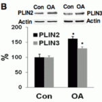 <strong>Figure 9  Induced Expression Validation of TIP47 in HT29 Cells (Qi et al., 2013) </strong><br>TIP47 expression detected by anti-TIP47 antibodies was increased in the colonic cells after oleic acid treatment.