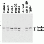 <strong>Figure 1 Western Blot Validation in Human Cell Lines</strong><br>Loading: 15 μg of lysates per lane.Antibodies: TIP47 3883, (1 µg/mL), 1h incubation at RT in 5% NFDM/TBST.Secondary: Goat anti-rabbit IgG HRP conjugate at 1:10000 dilution