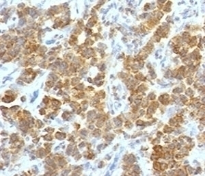 TL1A Antibody [TLRM1-1]