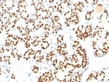 TLR2 Antibody [TLR2/221]