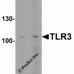 <strong> Figure 1 WB Validation  in Human Cells </strong><br>Loading: 15 μg of lysate Antibodies:  TLR3, 3643, 1 μ g/mL , 1 h incubation at RT in 5% NFDM/TBST. Secondary: Goat Anti-Rabbit IgG HRP conjugate at 1:10000 dilution.
