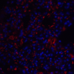 Immunofluorescence of TM4SF1 in mouse lung tissue with TM4SF1 antibody at 20 μg/mL.<br><br>Red: TM4SF1 Antibody (6229) <br> Blue: DAPI staining