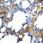 Immunohistochemistry of TM4SF1 in mouse lung tissue with TM4SF1 antibody at 5 μg/mL.