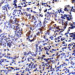 Immunohistochemistry of TM4SF1 in mouse lung tissue with TM4SF1 antibody at 2 μg/mL.