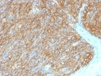 TMEM16A Antibody [DG1/1486]