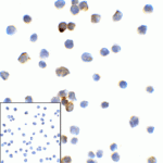 Immunocytochemistry of TMIGD2 in transfected HEK293 cells with TMIGD2 antibody at 2 μg/mL. Lower left: Immunocytochemistry in transfected HEK293 cells with control mouse IgG antibody at 2 μg/mL.