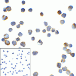 Immunocytochemistry of TMIGD2 in transfected HEK293 cells with TMIGD2 antibody at 2 μg/mL. Lower left: Immunocytochemistry in transfected HEK293 cells with control mouse IgG antibody at 2 μg/mL.