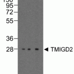 Western blot analysis of TMIGD2 in overexpressing HEK293 cells TMIGD2 antibody at 0.25, 0.5, and 1 μg/ml