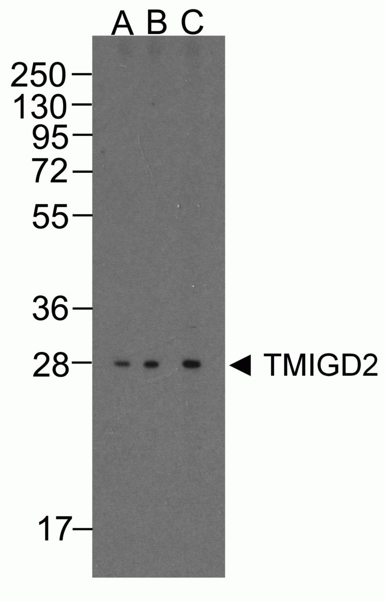 TMIGD2 Antibody [8A1]