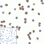Immunocytochemistry of TMIGD2 in transfected HEK293 cells with TMIGD2 antibody at 2 μg/mL. Lower left: Immunocytochemistry in transfected HEK293 cells with control mouse IgG antibody at 2 μg/mL.