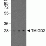 Western blot analysis of TMIGD2 in overexpressing HEK293 cells TMIGD2 antibody at 0.25, 0.5, and 1 μg/ml