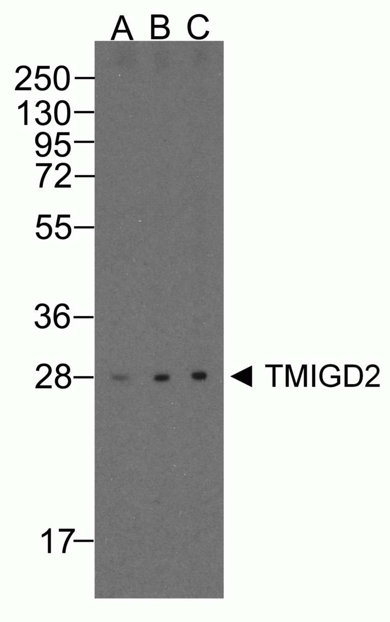 TMIGD2 Antibody [8G1]