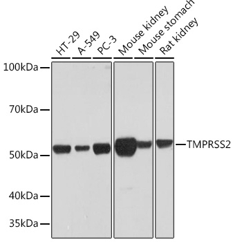 TMPRSS2 Antibody [ARC2373]