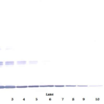 To detect Murine TNF-alpha by Western Blot analysis this antibody can be used at a concentration of 0.1-0.2 ug/ml. When used in conjunction with compatible secondary reagents, the detection limit for recombinant Murine TNF-alpha is 1.5-3.0 ng/lane, under either reducing or non-reducing conditions.