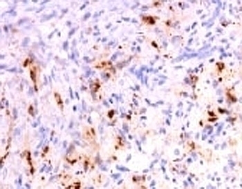 TNF-alpha Antibody [SPM543]