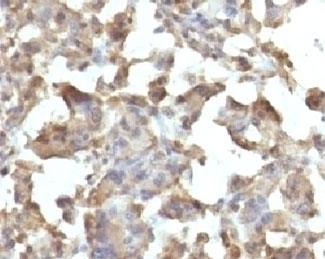 TNF alpha Antibody [TMDa1-1]