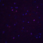Immunofluorescence of TNFAIP1 in mouse brain tissue with TNFAIP1 antibody at 20 μg/ml.<br><br>Red: TNFAIP1 Antibody (8345) <br> Blue: DAPI staining