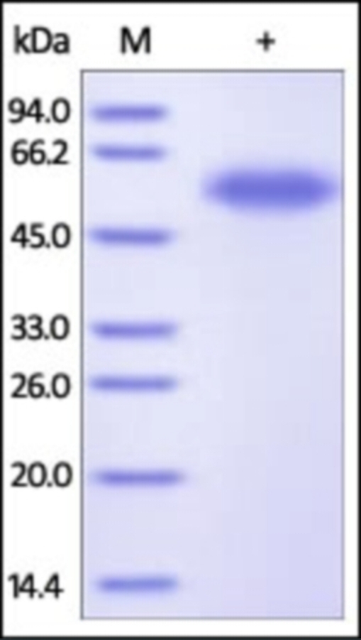 TNFR1 Recombinant Protein