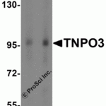 Western blot analysis of TNPO3 expression in Jurkat cell lysate with TNPO3 antibody at (A) 1 and (B) 2 μg/ml.