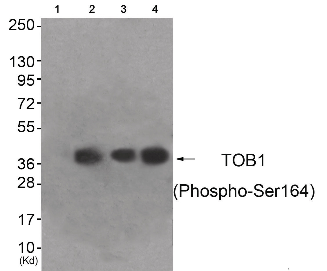 TOB1 (phospho Ser164) Antibody