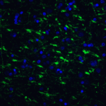 Immunofluorescence of TOLLIP in human brain tissue with TOLLIP antibody at 20 μg/ml.<br><br>Green: TOLLIP Antibody (3741) <br> Blue: DAPI staining
