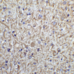 Immunohistochemistry of TOLLIP in human brain tissue with TOLLIP antibody at 5 μg/ml.