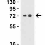 <strong>Figure 3 Western Blot Validation in Human Brain </strong><br>Loading: 15 μg of lysates per lane.Antibodies: TOM70 4959 (Lane 1: 1 μg/mL and Lane 2: 2 μg/mL), 1h incubation at RT in 5% NFDM/TBST.Secondary: Goat anti-rabbit IgG HRP conjugate at 1:10000 dilution.