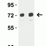 <strong>Figure 4 Western Blot Validation in Rat Brain </strong><br>Loading: 15 µg of lysates per lane.Antibodies: TOM70 4949 (Lane 1: 2 μg/mL and Lane 2: 4 μg/mL), 1h incubation at RT in 5% NFDM/TBST.Secondary: Goat anti-rabbit IgG HRP conjugate at 1:10000 dilution.