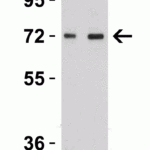 <strong>Figure 5 Western Blot Validation in Rat Brain </strong><br>Loading: 15 µg of lysates per lane.Antibodies: TOM70 4959 (A: 1 μg/mL and B: 2 μg/mL), 1h incubation at RT in 5% NFDM/TBST.Secondary: Goat anti-rabbit IgG HRP conjugate at 1:10000 dilution.