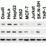 <strong>Figure 1 Independent Antibody Validation (IAV) via Protein Expression Profile in Human, Mouse and Rat Cell Lines</strong><br>Loading: 15 μg of lysates per lane.Antibodies: TOM70 4949 (2 μg/mL), TOM70 4959 (2 μg/mL) and beta-actin (1 μg/mL), 1h incubation at RT  in 5% NFDM/TBST.Secondary: Goat anti-rabbit IgG HRP conjugate at 1:10000 dilution.