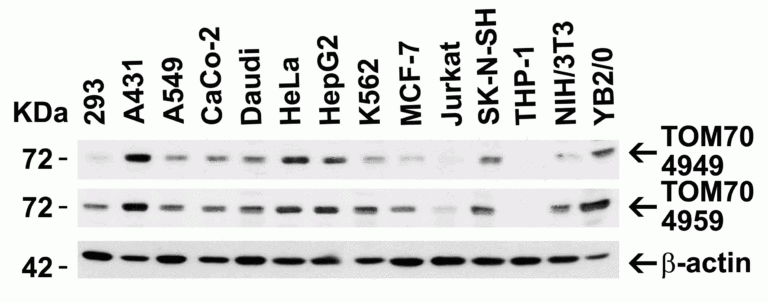 TOM70 Antibody