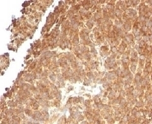 TOP1MT Antibody [TPIMT-1]