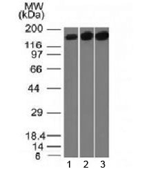 TOP2A Antibody [TOP2A/1361]