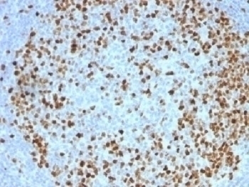TOP2A Antibody [TOP2A/1362]