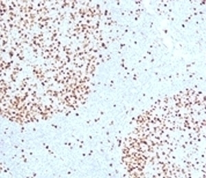 TOP2A Antibody [TPM2A-1]
