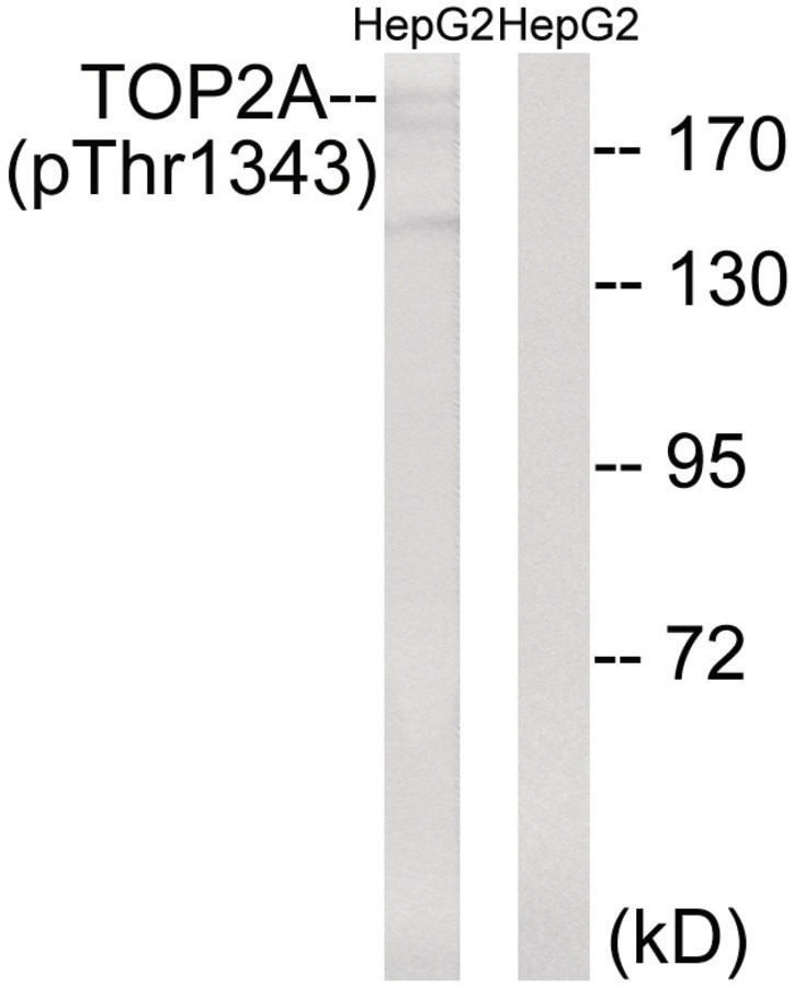 TOP2A (phospho Thr1343) Antibody