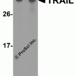 Western blot analysis of TRAIL in human brain tissue lysate with TRAIL antibody at (A) 2.5 and (B) 5 μg/mL.