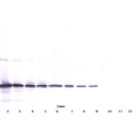 To detect Murine TRAIL by Western Blot analysis this antibody can be used at a concentration of 0.1 - 0.2 mg/ml. When used in conjunction with compatible development reagents the detection limit for recombinant Murine TRAIL is 1.5 – 3.0 ng/lane, under either reducing or non-reducing conditions.