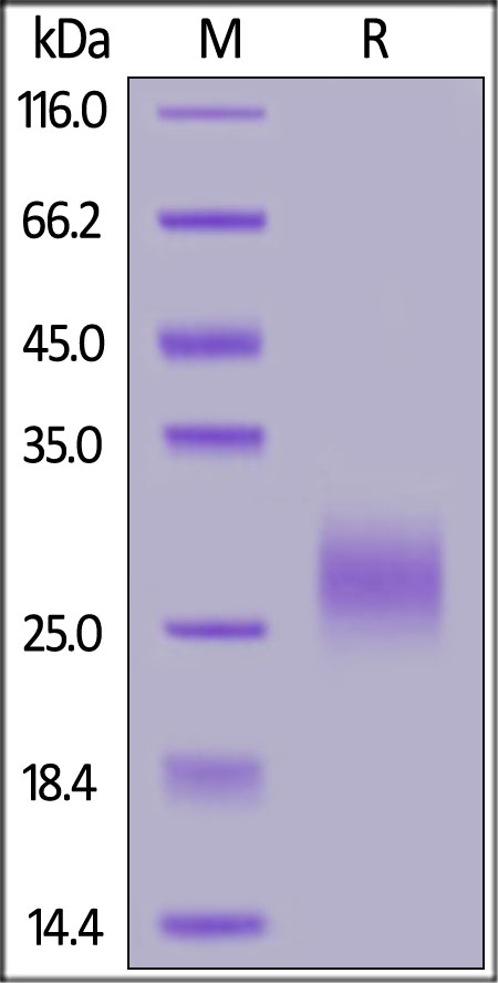 TRAIL R2 / DR5 / TNFRSF10B Recombinant Protein