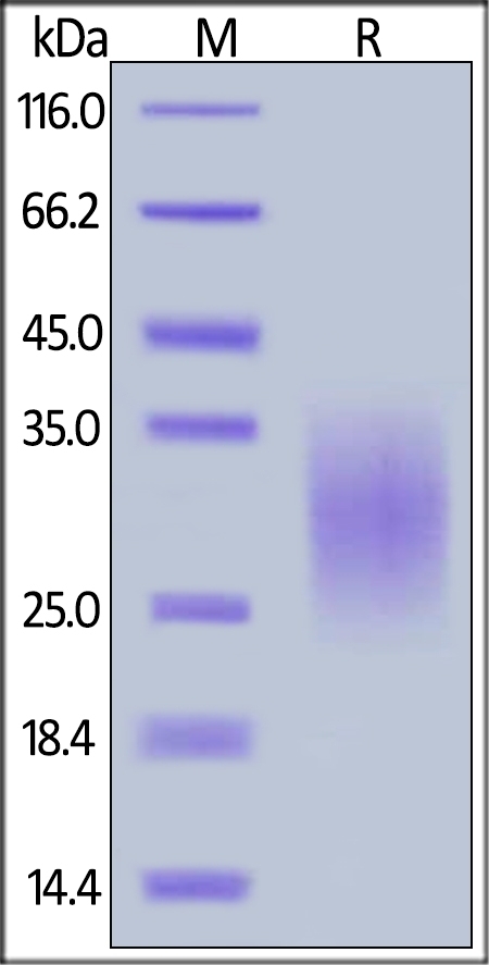 TRAIL R2 / DR5 / TNFRSF10B Recombinant Protein