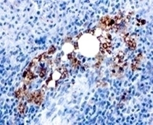 TRAcP Antibody [ACP5/1070]