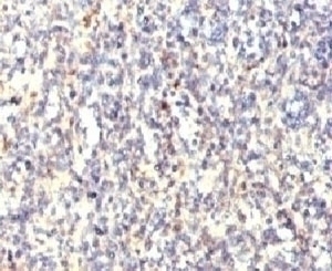 TRAcP Antibody [HACP5-1]