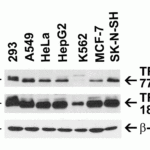 <strong>Figure 2 Independent Antibody Validation (IAV) via Protein Expression Profile in Human Cell Lines</strong><br>Loading: 15 μg of lysates per lane.Antibodies: TRIM21, 7729 (0.5 μg/mL), TRIM21, 18-413 (2 μg/mL), and beta-actin (1 μg/mL),  1h incubation at RT  in 5% NFDM/TBST.Secondary: Goat anti-rabbit IgG HRP conjugate at 1:10000 dilution.