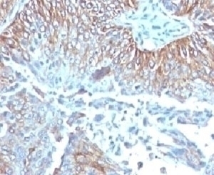 TRIM29 Antibody [TPMP29-1]