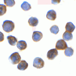 Immunocytochemistry of TRIP12 in Hela cells with TRIP12 Antibody at 2 μg/ml.