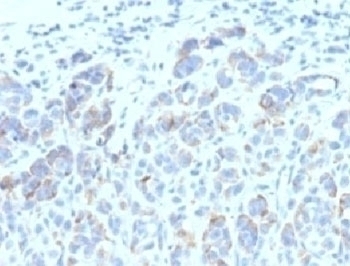 TRP1 Antibody [SPM611]