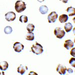 Immunocystochemistry of TRPC6 in K562 cells with TRPC6 antibody at 2 μg/mL.