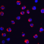 Immunofluorescence of TRPC6 in K562 cells with TRPC6 antibody at 5 μg/ml.<br><br>Red: TRPC6 Antibody (3899) <br> Blue: DAPI staining