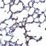 Immunohistochemistry of TRPC6 in mouse lung tissue with TRPC6 antibody at 5 μg/ml.